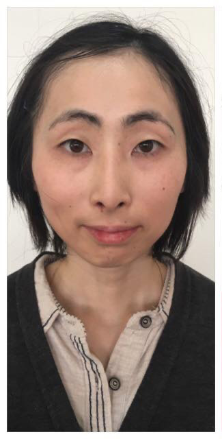 若林　朋子 Before